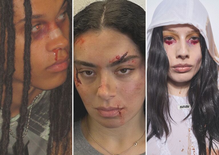 La estética del dolor: Cómo el sufrimiento se convirtió en una tendencia ¿cool?